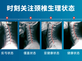 颈椎病的分类